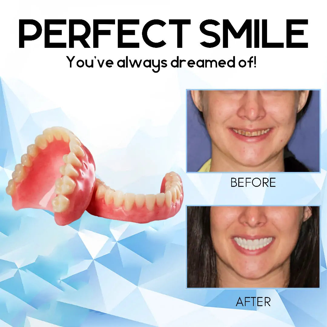 Removable Cosmetic Teeth Veneers for Adults – Instant Smile Enhancer with Silicone Liner, Reusable Snap-On Dental Cover for Natural Look | Thomler