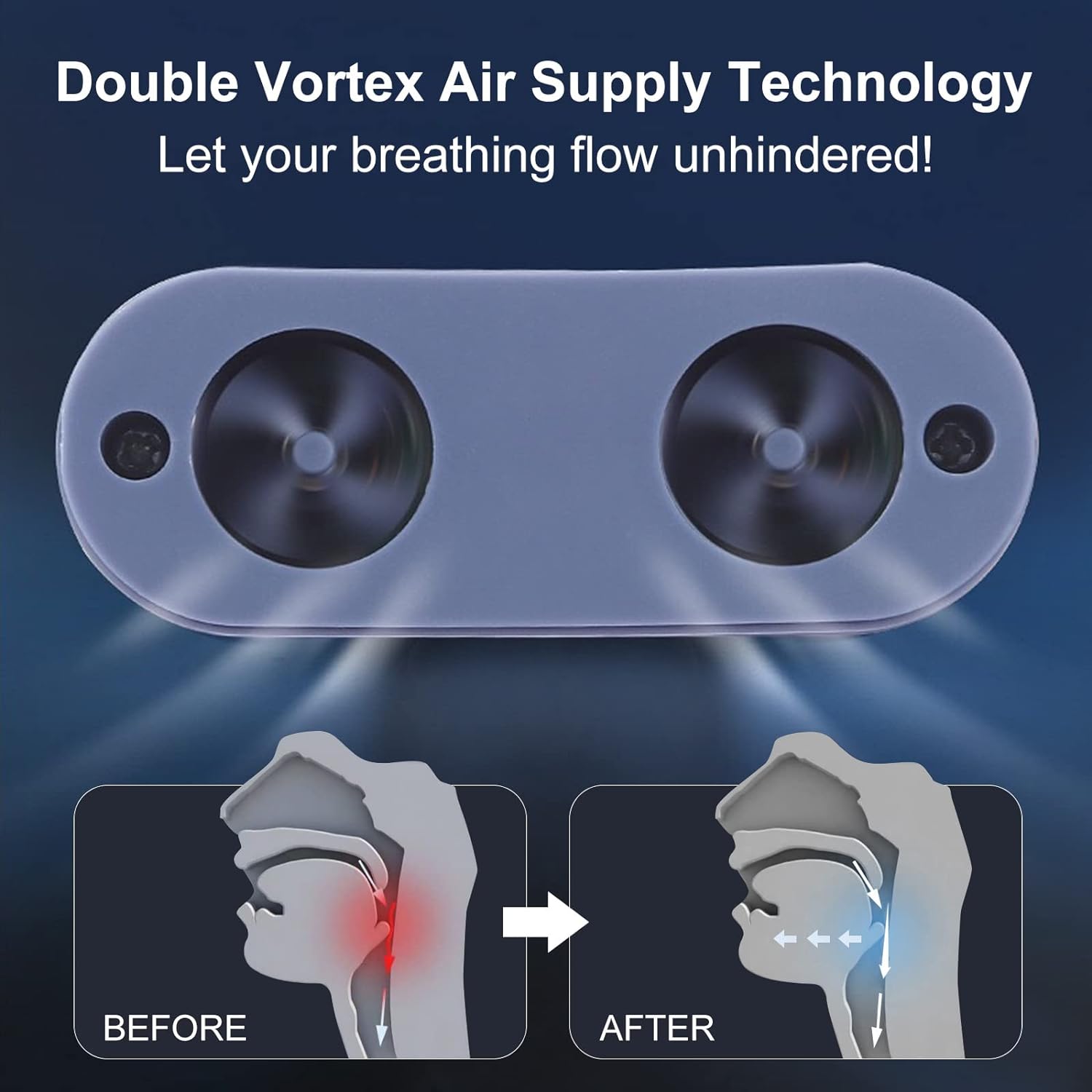 Nasal Sleep Aid Device for Snoring Relief and Better Breathing – Compact, Maskless Design for Home or Travel | Thomler