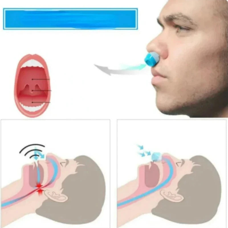 Nasal Dilator Clip with Built-In Air Filter for Nighttime Breathing Support | Thomler