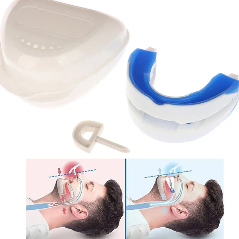 Adjustable Mandibular Advancement Device for Snoring Relief & Better Sleep | Anti-Snore Mouthpiece for Men & Women | Thomler