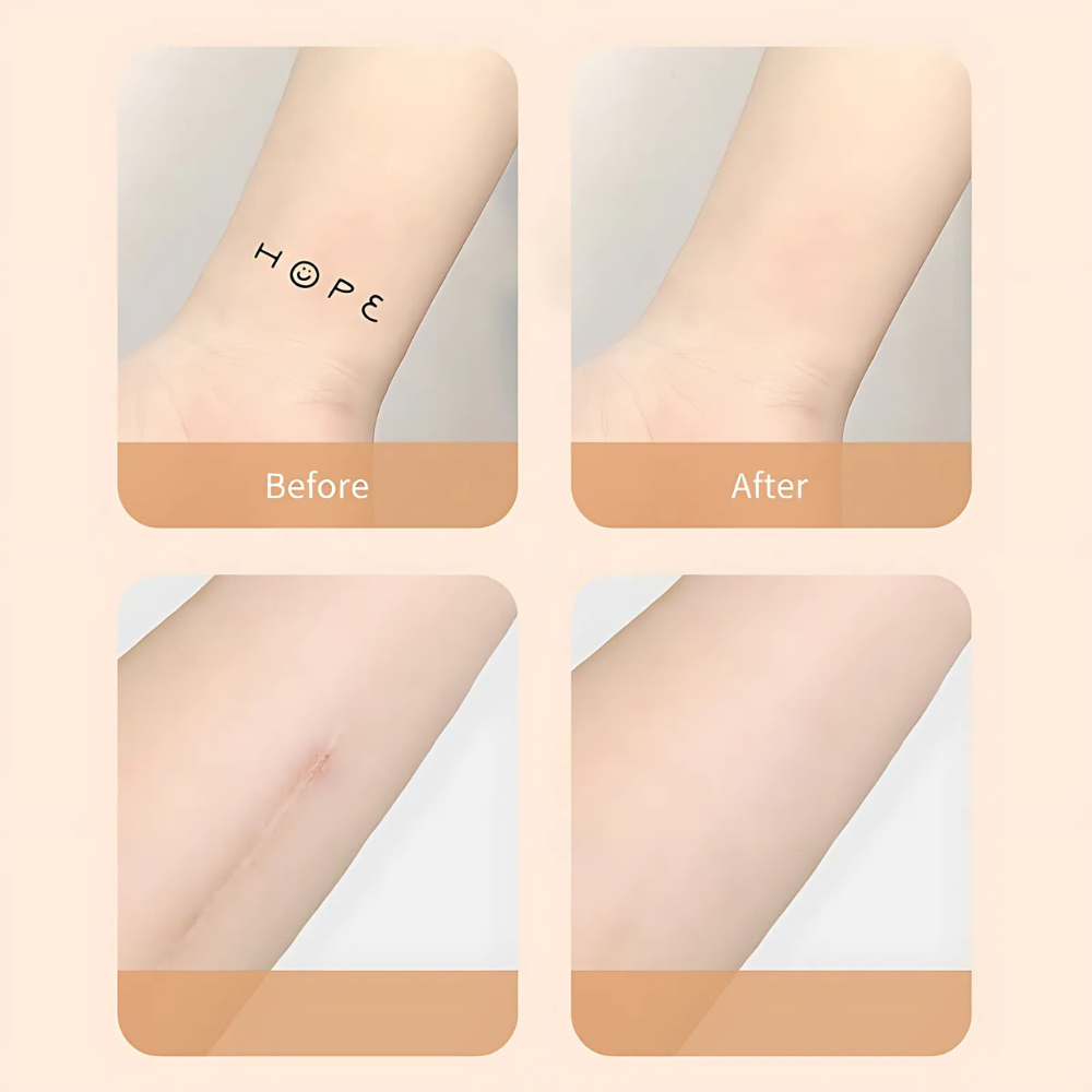 Skin Tone Adhesive Bandage Strips for Tattoo and Scar Coverage Waterproof Breathable Ultra-Thin Body Concealing Film Patches for Swimming | Thomler