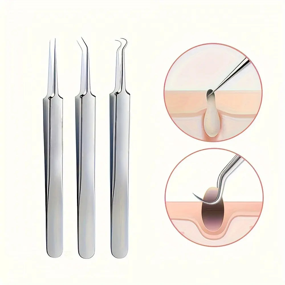 Stainless Steel Pore Extractor Tools for Acne, Clogged Pores, and Blemish Care at Home – Professional Skincare Set | Thomler