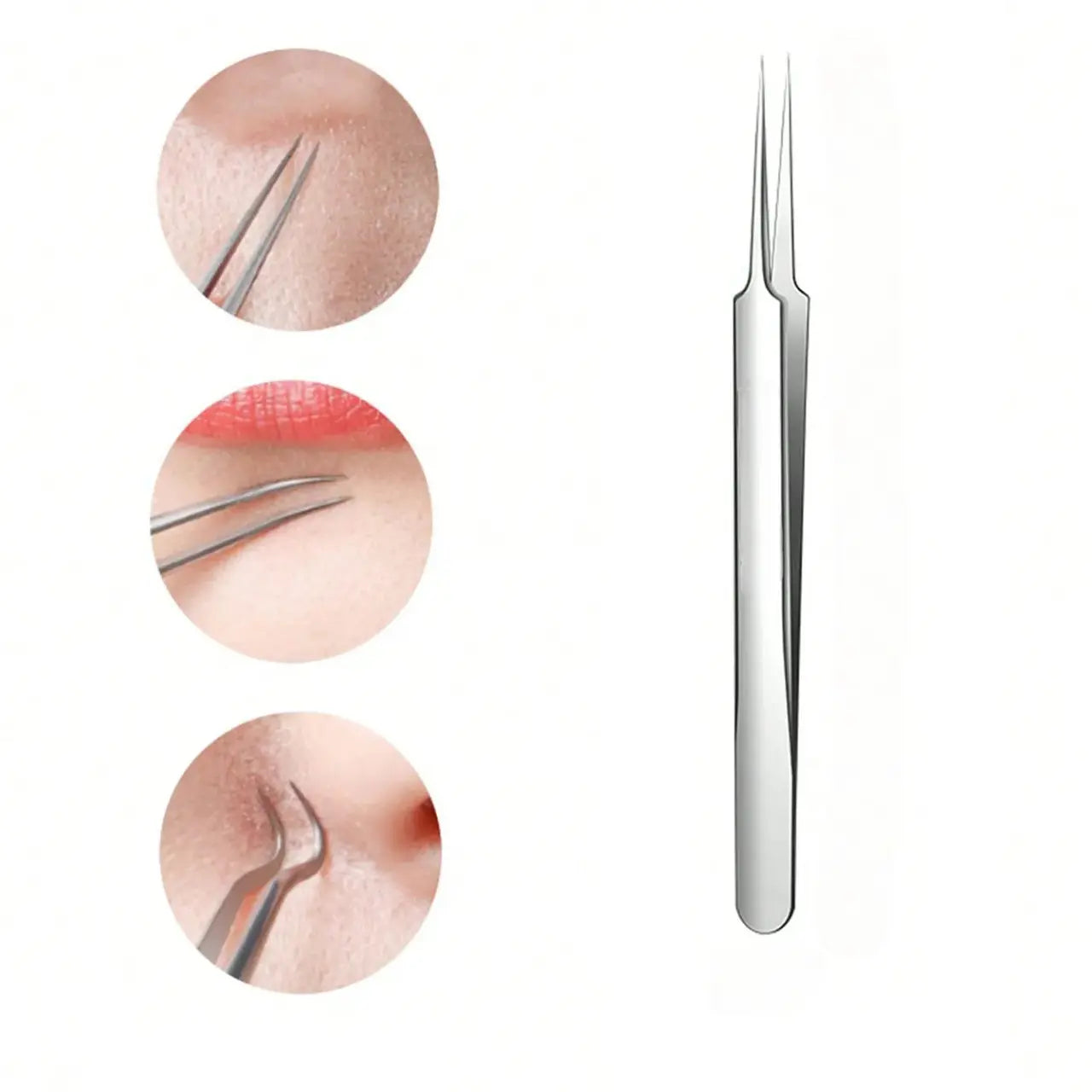 Stainless Steel Pore Extractor Tools for Acne, Clogged Pores, and Blemish Care at Home – Professional Skincare Set | Thomler