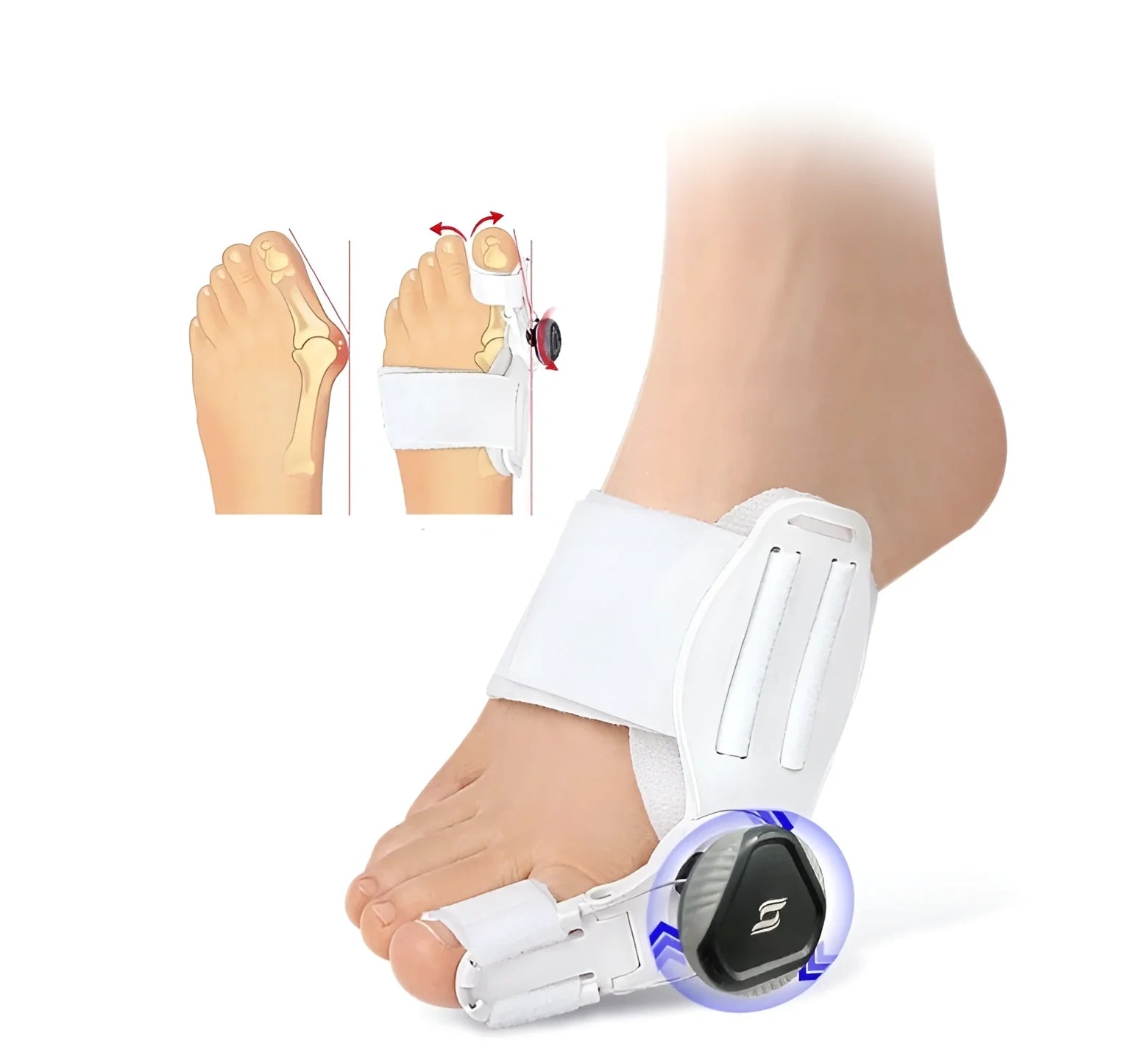 Adjustable Big Toe Splint for Bunion Relief & Alignment | Hinged Night Brace for Pain-Free Walking & Sleep Recovery | Thomler