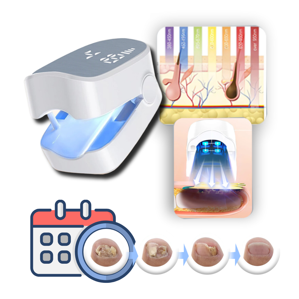 Rechargeable Light Therapy Device for Nail Care, Dual Mode Blue LED & Cold Laser Treatment, Portable 7-Minute Daily Use for Toenails & | Thomler