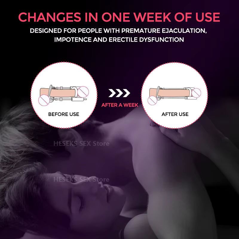 Medical-Grade Penile Extender for Natural Enhancement | Adjustable Traction System for Lasting Results | Thomler
