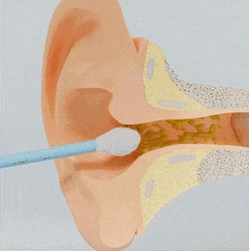 Visual Ear Wax Removal Tool with HD Camera Scope for iPhone Android Wireless Ear Cleaning Kit Safe Scoop Adults Kids | Thomler