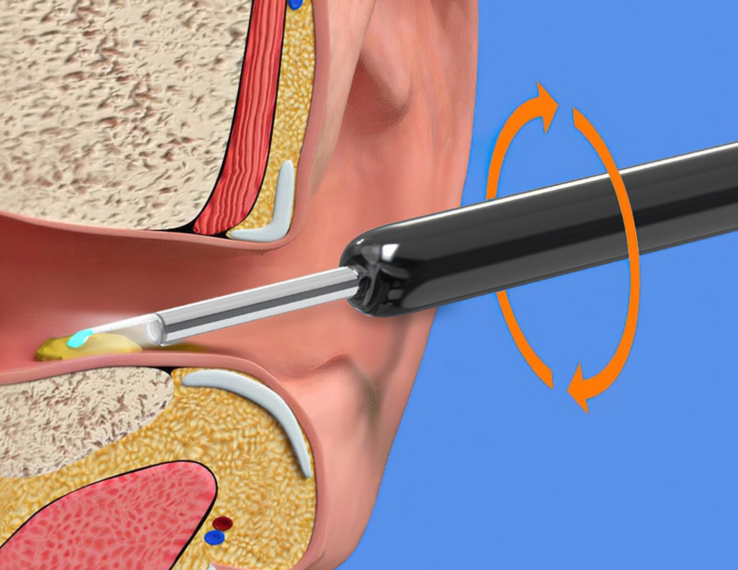 Wireless Ear Cleaning Camera with HD Scope and Silicone Tip for iPhone & Android Safe Wax Removal Tool | Thomler