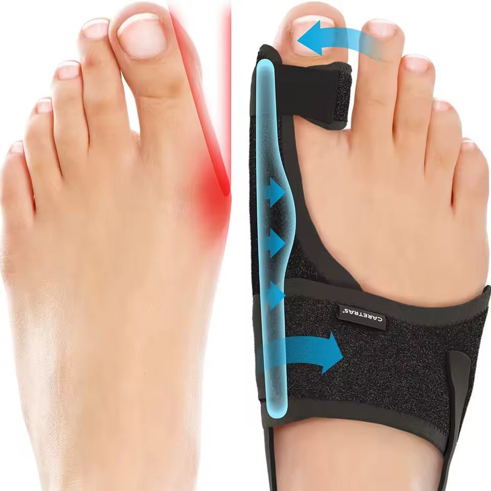 Adjustable Bunion Corrector Night Splint for Big Toe Alignment – Ergonomic Hallux Valgus Support Brace for Left or Right Foot, Comfortable | Thomler
